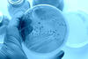 Bakterien: Person hält Petrischale mit Bakterien
